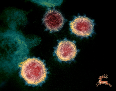 db_bilder/400/coronavirus_SARS-CoV-2-wiki_niaid--20200310.png